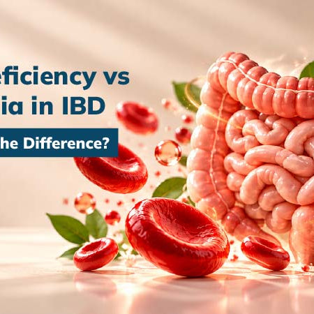 Iron Deficiency vs Anemia in IBD: What's the Difference?