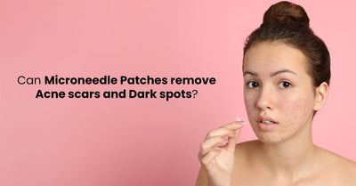 Can Microneedle Patches remove Acne scars and Dark spots?