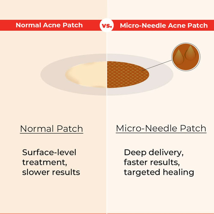 bbold Dissolvable Microneedle Acne Patch | Targets Pimples at the Root | Ultra - Thin, Invisible & Makeup - Friendly | Hyaluronic Acid & Salicylic Acid | Heals in 6 - 8 Hours | Each Pack Has 9 Pcs - Azistastore