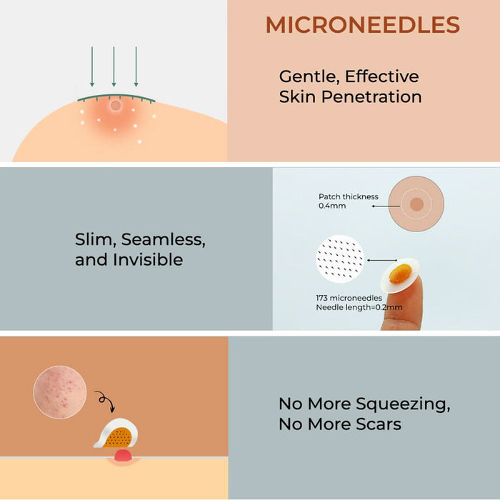 bbold Dissolvable Microneedle Acne Patch | Targets Pimples at the Root | Ultra - Thin, Invisible & Makeup - Friendly | Hyaluronic Acid & Salicylic Acid | Heals in 6 - 8 Hours | Each Pack Has 9 Pcs - Azistastore