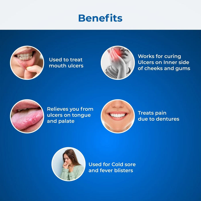 UlFree Mouth Ulcer Pain Relief Gel - Azistastore